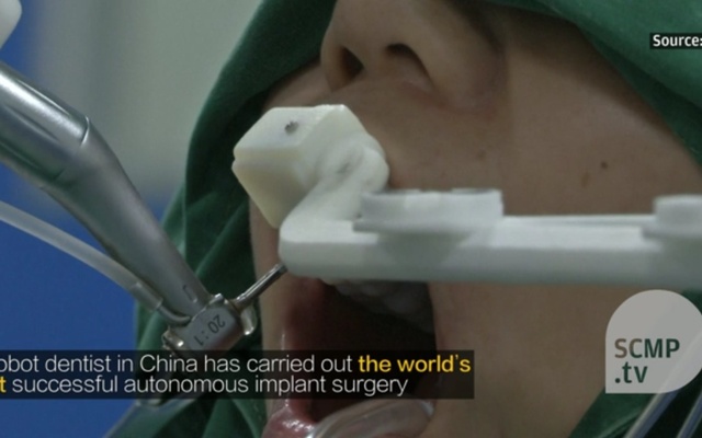 মানুষের দাঁতে রোবটের অস্ত্রোপচার