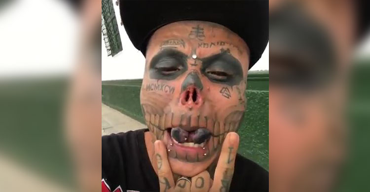 নাক কাটলো যুবক