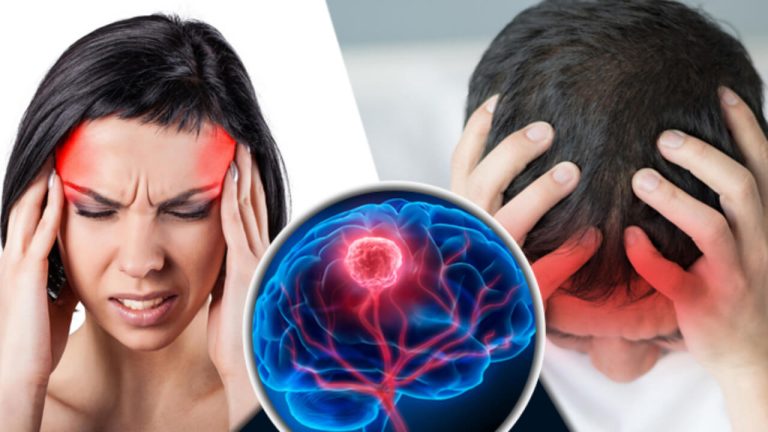 ব্রেন টিউমার